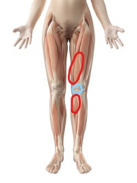 変形性膝関節症２