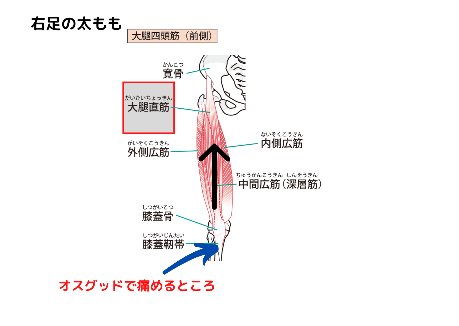 サッカー選手の膝の痛み オスグッド の悩み解消 川西市宝塚市伊丹市西宮市池田市豊中市